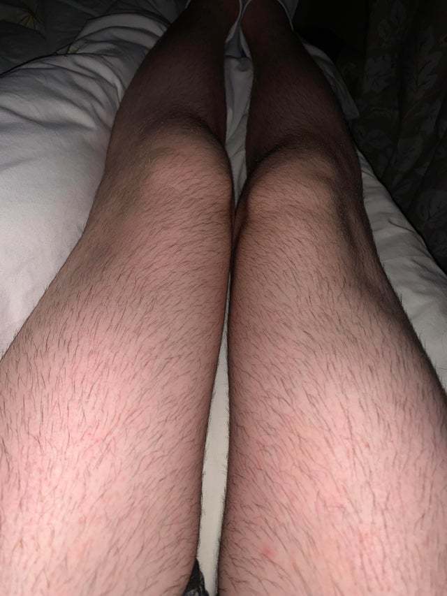 Should I continue to grow it out more or shave/close trim it back?
