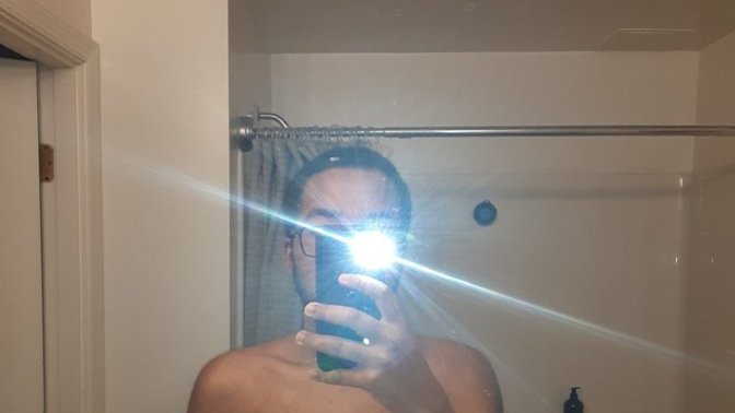 Should I consider weight loss surgery or am I just facing normal body dysmorphia?