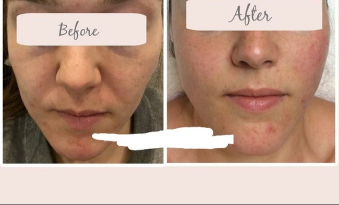 Doesnt the after picture look worse than the before picture?