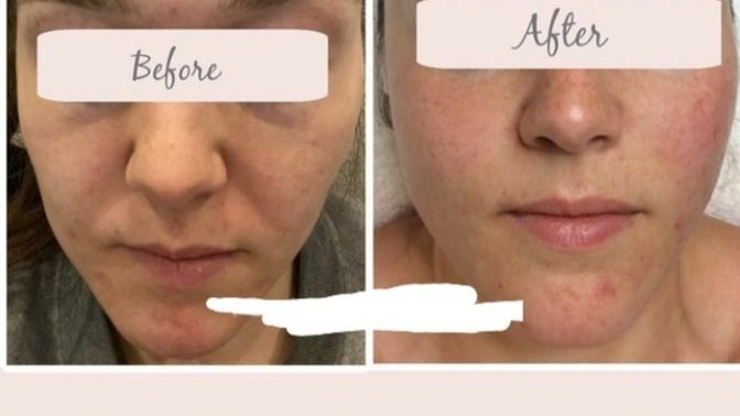 Doesn't the after picture look worse than the before picture?
