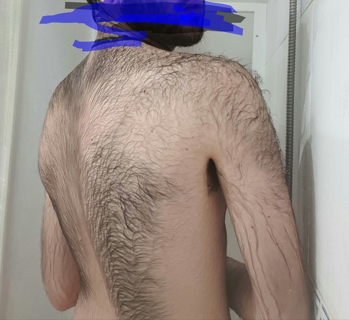 If a guy is overly hairy bodied?