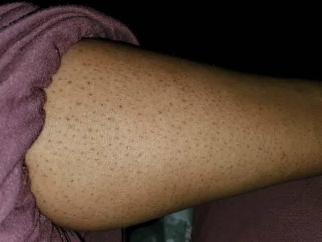 I envy women for their smooth legs which motivates me to shave mine?
