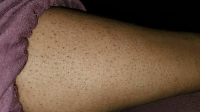 I envy women for their smooth legs which motivates me to shave mine?