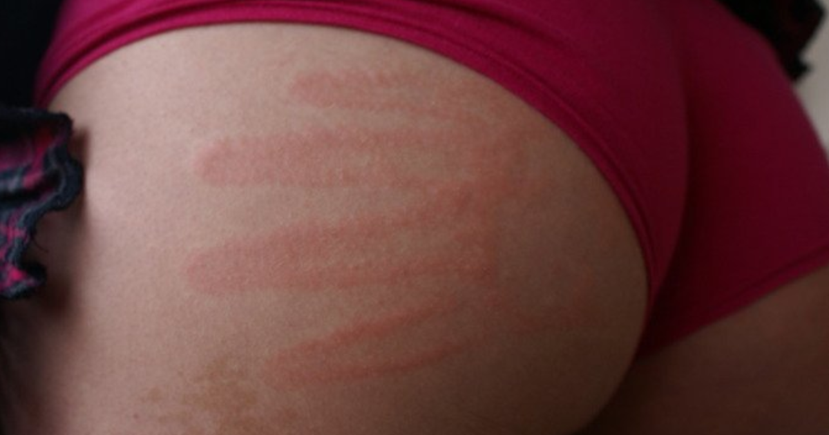 Why do girls like their butts smacked during sex? - GirlsAskGuys