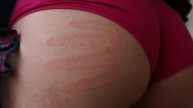 Why do girls like their butts smacked during sex?