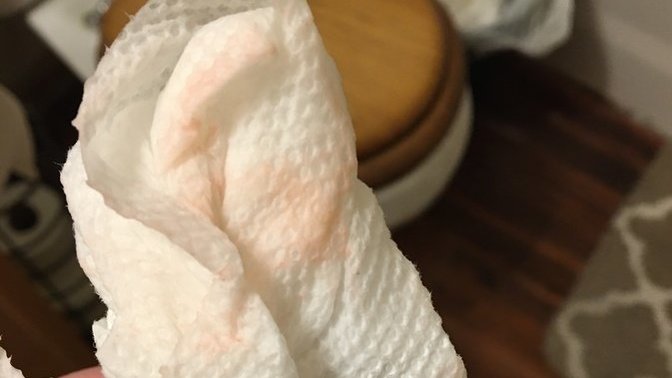 Is it water or the air, that turned this napkin red?