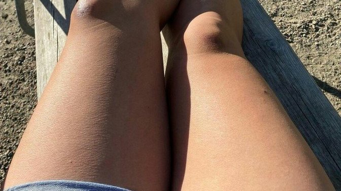 Guys with epilated smooth legs?