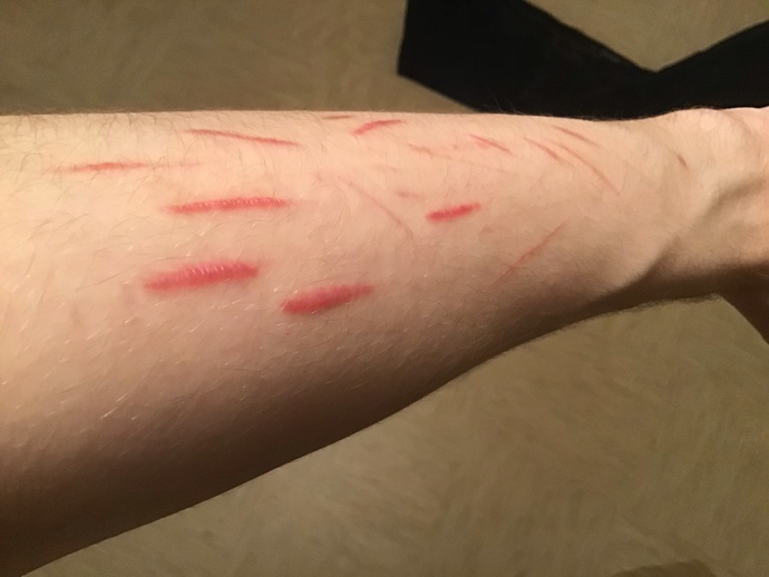 Will my scars fade?