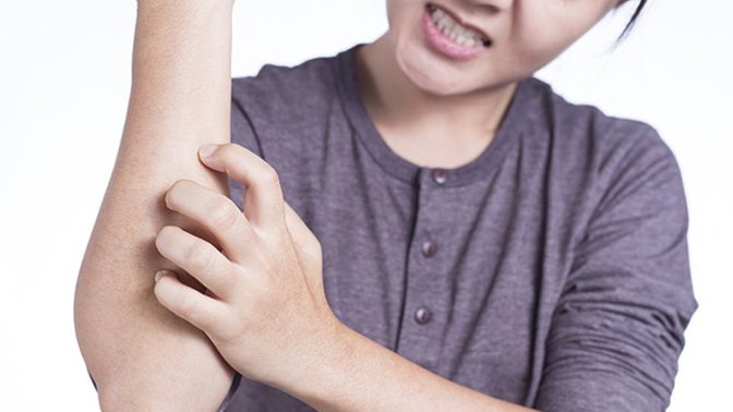 I keep feeling itchy and scratching a lot, but I have no rash. What is wrong with me?