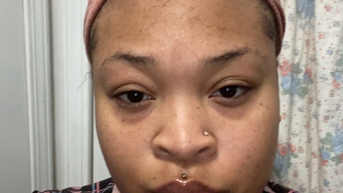 Are these eyebags or dark circles or just a shadow. so insecure about them, how do I fix it?
