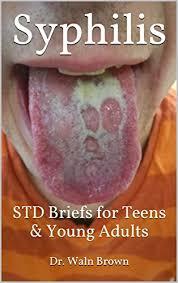 If you knew you were going to get a STD, would you still have sex?