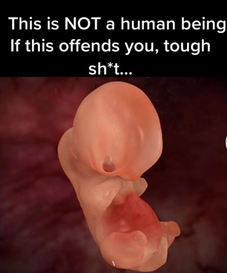 You know its not a human right?