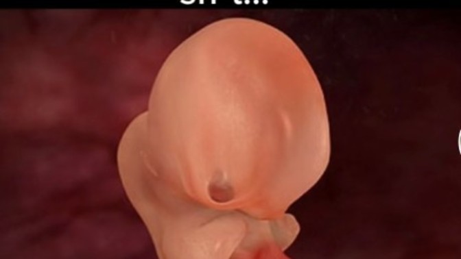 You know its not a human right?