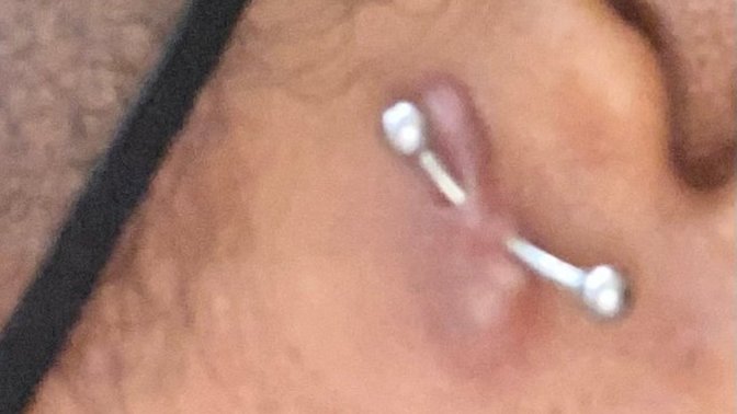 What should I do about my surface tragus piercing?