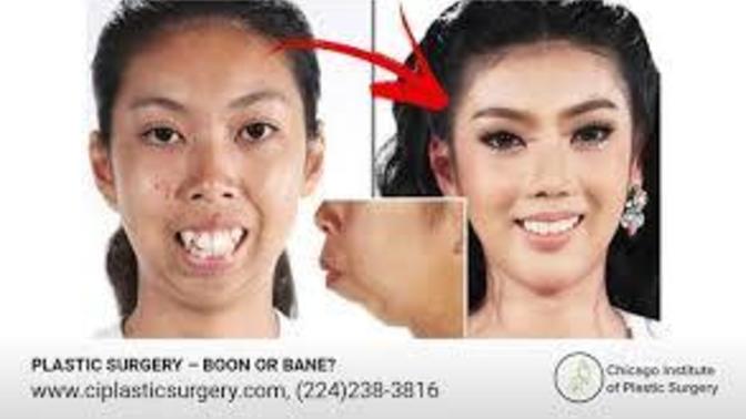Should we make plastic surgery acceptable in the west?