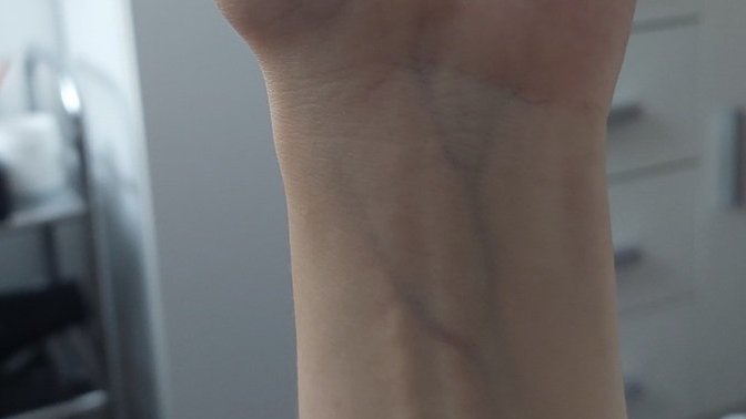 Are my veins blueish or greenish?