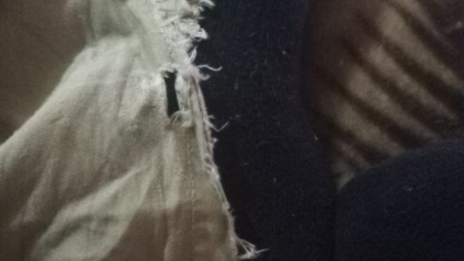 Does this ever happen to your pants?