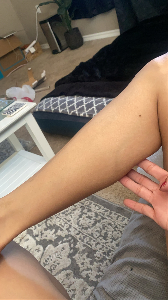 POLL- How can I get muscle on skinny legs help?