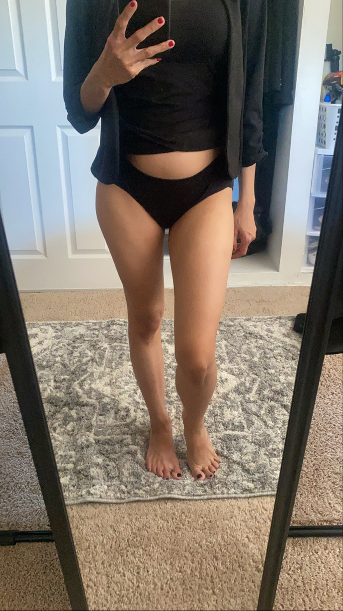 POLL- How can I get muscle on skinny legs help?