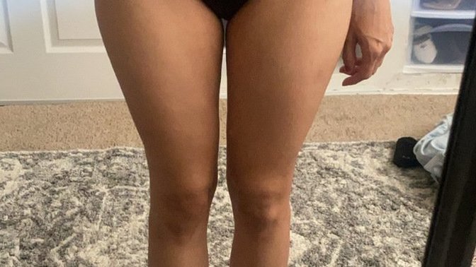 POLL- How can I get muscle on skinny legs help?
