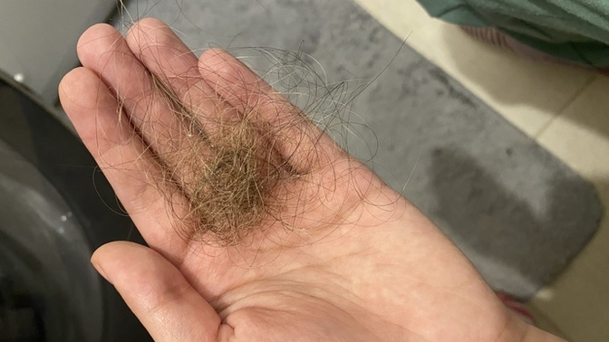 Is this normal hair loss when washing hair?