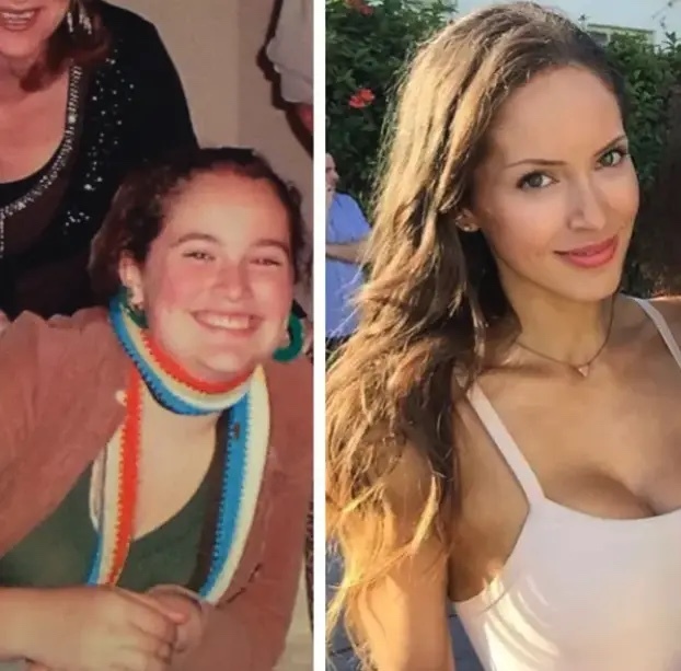 What age do most girls lose their baby face?