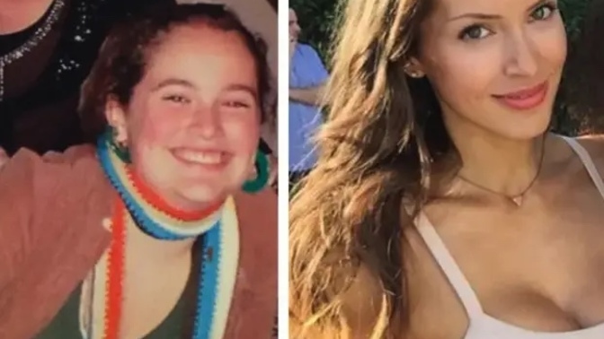 What age do most girls lose their baby face?