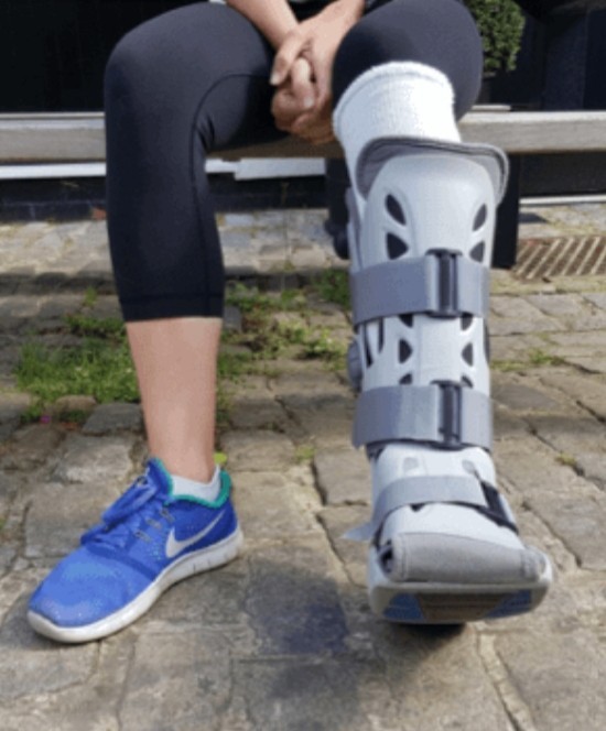 Would you wear a brace or multiple braces for fun?