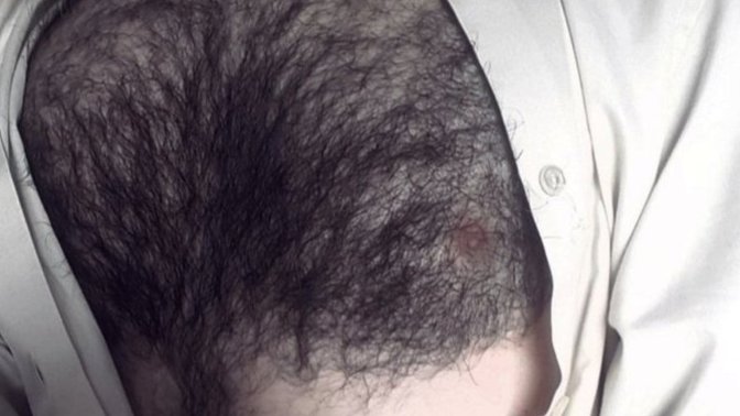 Excessively hairy torso on a man , isn't it a reason to be insecure and self conscious?