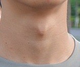 Do women find a more pronounced Adams Apple on a man more or less appealing?