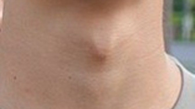 Do women find a more pronounced Adams Apple on a man more or less appealing?