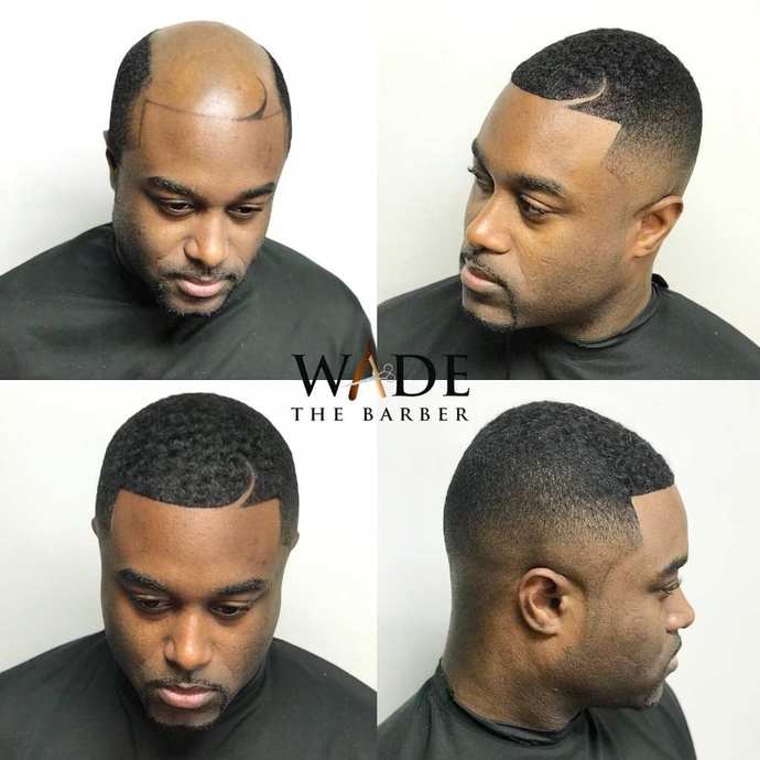 When men are balding, why don’t they embrace it?