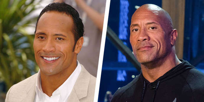 When men are balding, why don’t they embrace it?