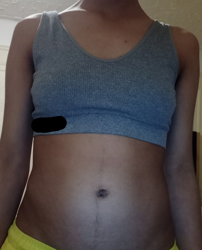 How can I make my pouch go away ;(?