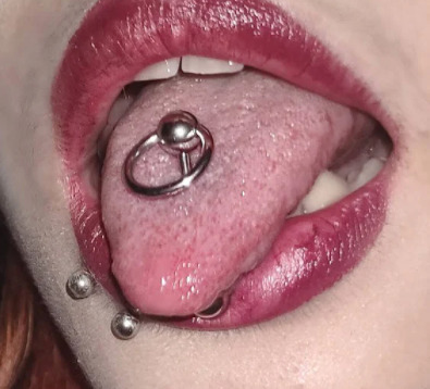 Which Ball For My Tongue Piercing I should Get!?!?