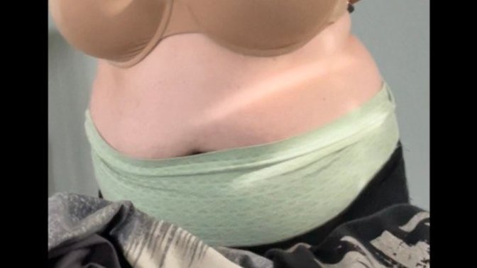 Does anyone else’s belly do this when they lose weight?