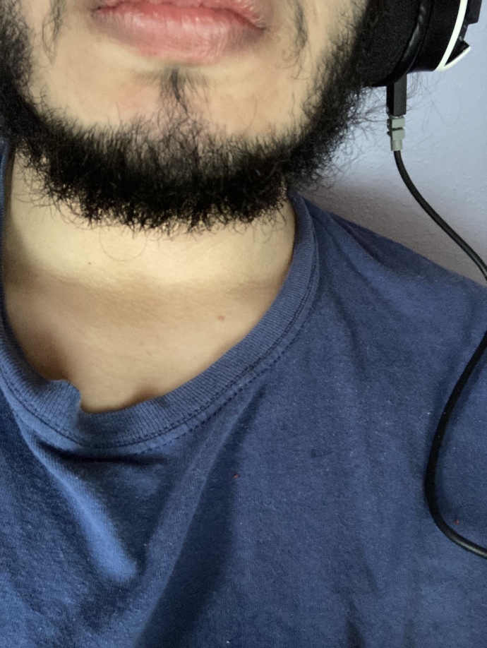 What do you do about the hair on your chinny-chin-chin?