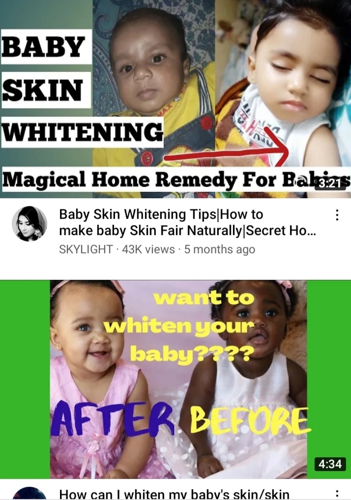 What do you think about skin whitening babies?