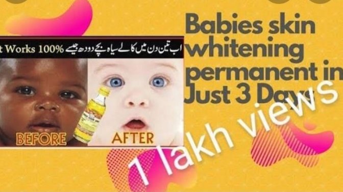 What do you think about skin whitening babies?