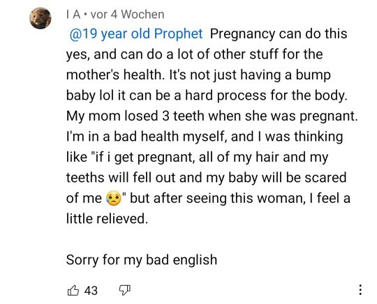 Do women loose their hair and teeth due to pregnancy? Did you loose your teeth due to pregnancy?