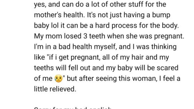 Do women loose their hair and teeth due to pregnancy? Did you loose your teeth due to pregnancy?
