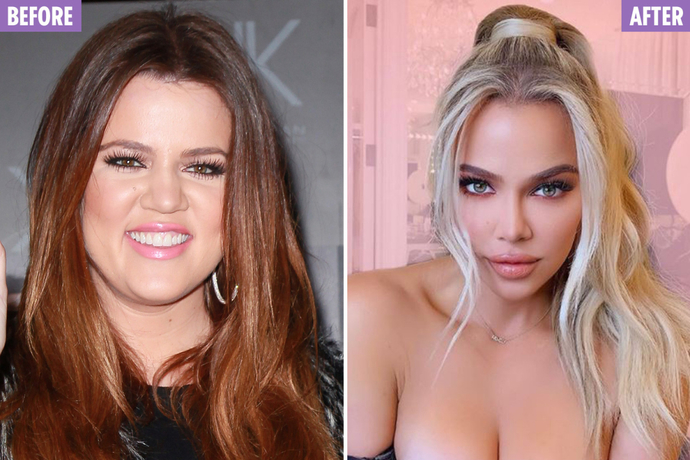 Khloe