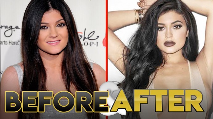Kylie