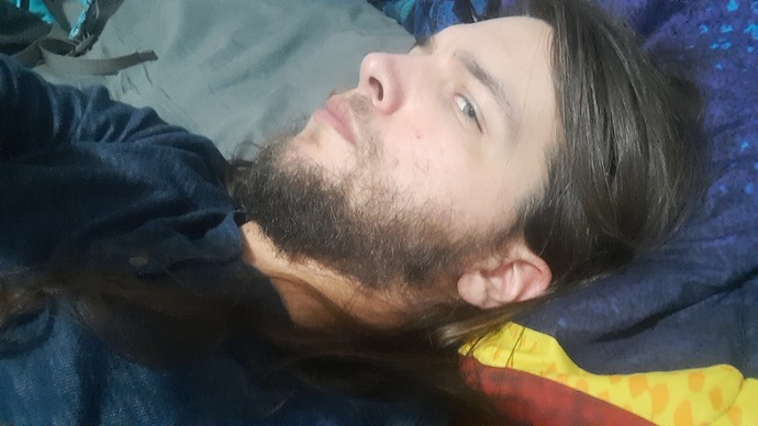 Should I get plastic surgery to fix my ugliness? Do you think itll even help?