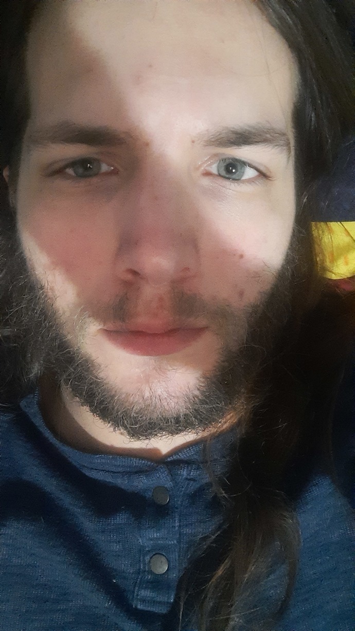 Should I get plastic surgery to fix my ugliness? Do you think itll even help?