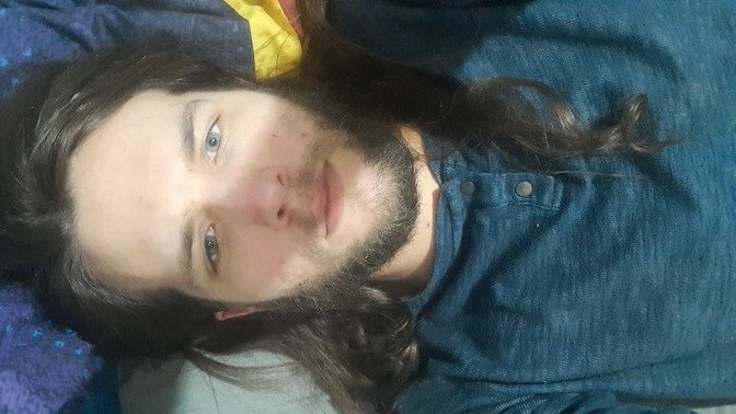 Should I get plastic surgery to fix my ugliness? Do you think it'll even help?