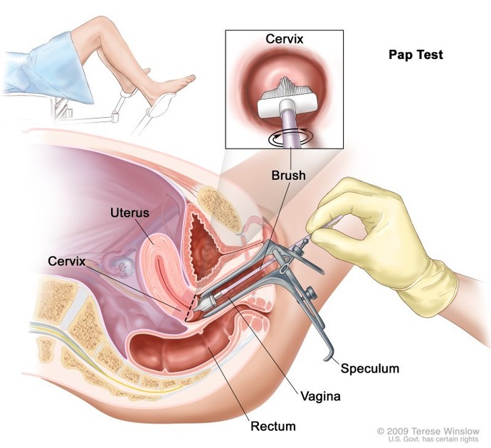 Are pap smears painful?
