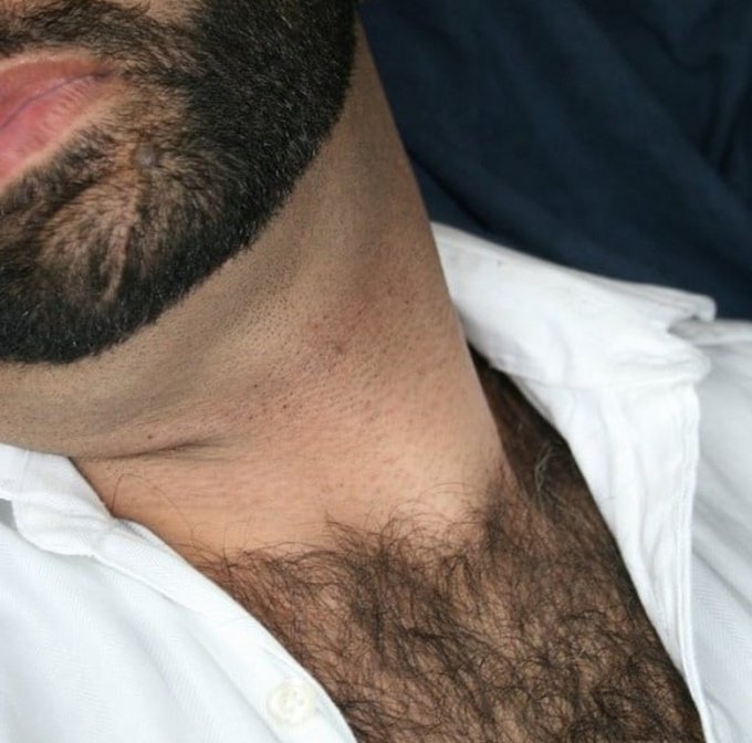 If you notice quite thick upper chest hair?