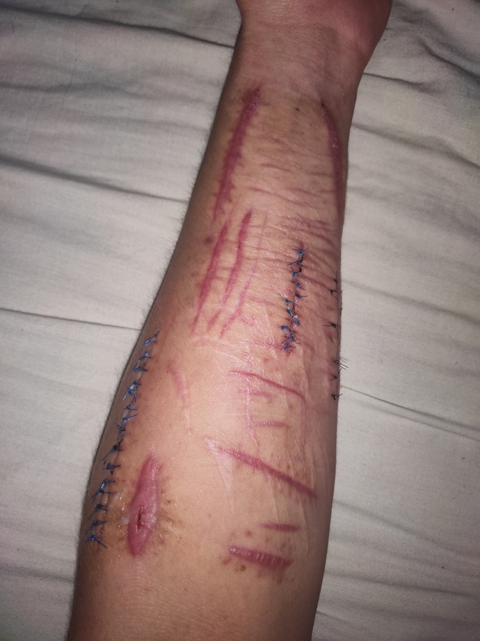 Would you date someone who is covered in scars?