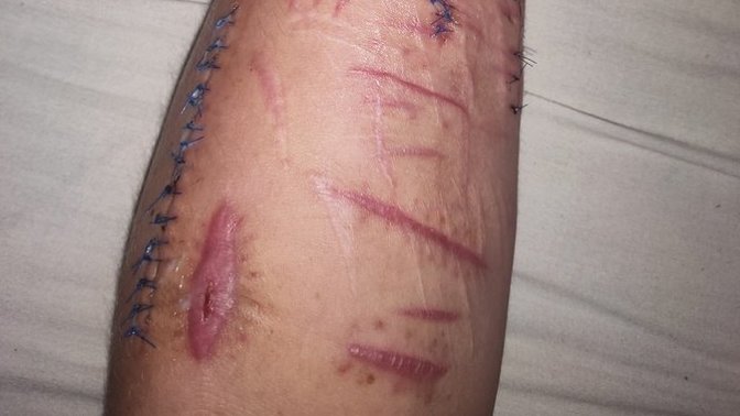 Would you date someone who is covered in scars?
